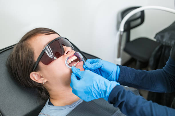 Best Knocked-Out Tooth (Avulsed Tooth) Treatment in Holiday, FL